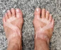 chaco feet.webp