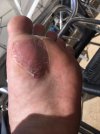 pad-blister.jpg